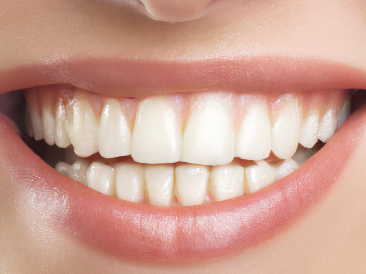 Before Image: Dental Smile - front